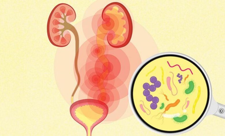 idrar yolu enfeksiyonu