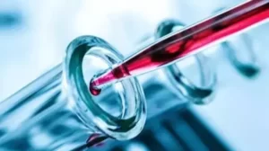 egfr kaç olmalıdır