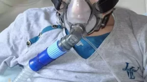 Kistik fibrozis nedir