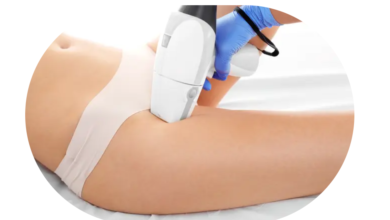 regl iken lazer yapılır mı